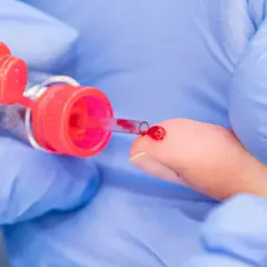 Eine Hand in blauen Handschuhen führt eine kapillare Blutentnahme durch. Ein Tropfen Blut sammelt sich auf der Fingerspitze, bereit für die Entnahme in ein Röhrchen.