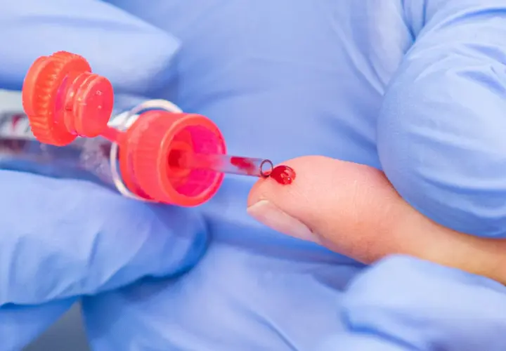 Eine Hand in blauen Handschuhen führt eine kapillare Blutentnahme durch. Ein Tropfen Blut sammelt sich auf der Fingerspitze, bereit für die Entnahme in ein Röhrchen.