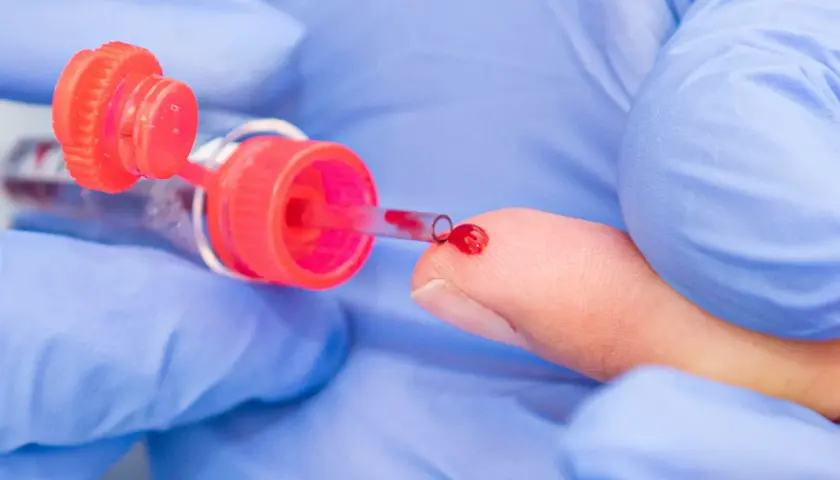 Eine Hand in blauen Handschuhen führt eine kapillare Blutentnahme durch. Ein Tropfen Blut sammelt sich auf der Fingerspitze, bereit für die Entnahme in ein Röhrchen.