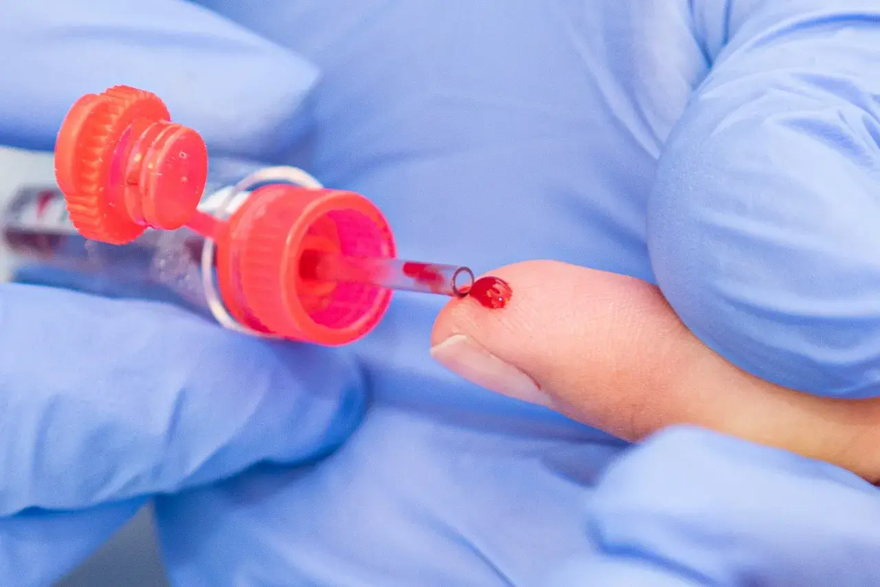 Eine Hand in blauen Handschuhen führt eine kapillare Blutentnahme durch. Ein Tropfen Blut sammelt sich auf der Fingerspitze, bereit für die Entnahme in ein Röhrchen.